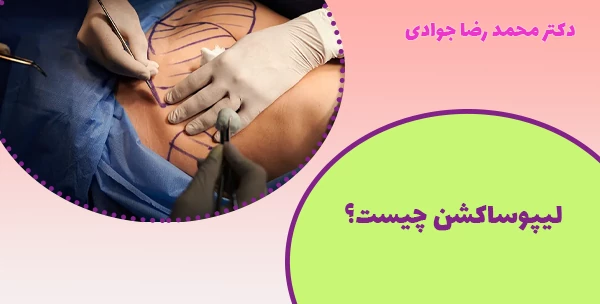 لیپوساکشن چیست؟