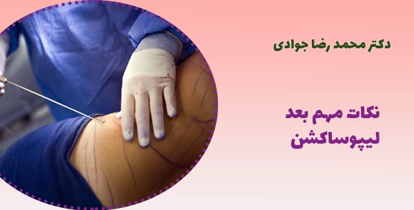 نکات مهم بعد لیپوساکشن
