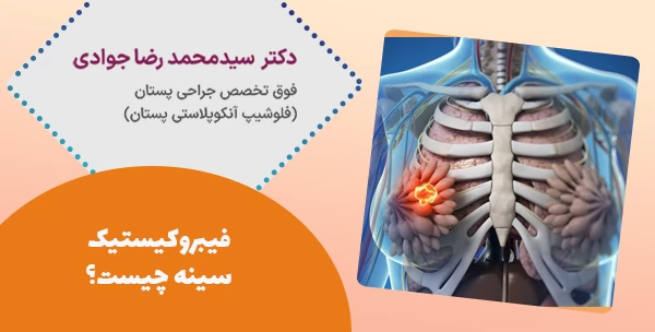 فیبروکیستیک سینه چیست؟