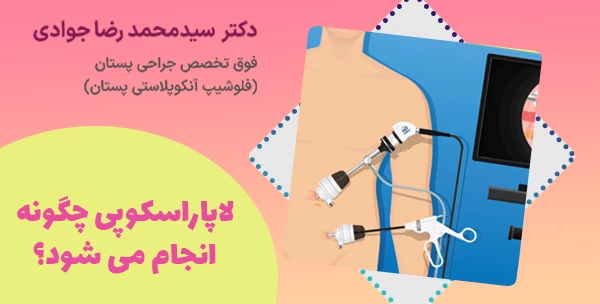 لاپاراسکوپی چگونه انجام می شود؟