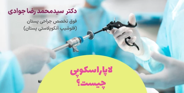لاپاراسکوپی چیست؟
