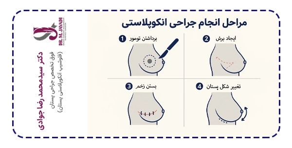 مراحل جراحی انکوپلاستی