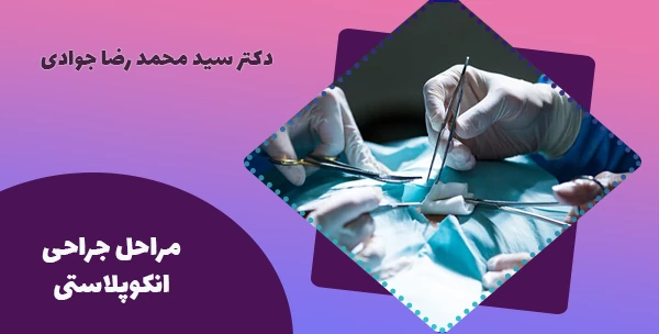 مراحل جراحی انکوپلاستی