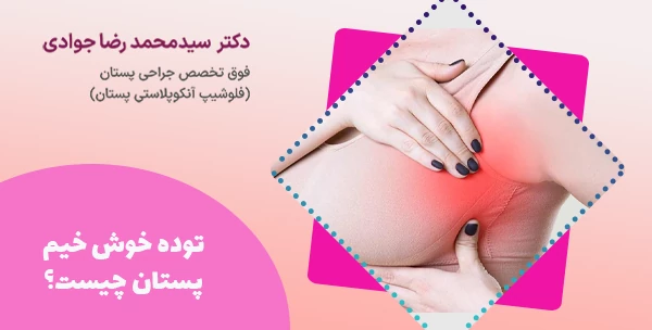 توده خوش خیم پستان چیست؟