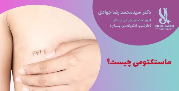 ماستکتومی چیست؟