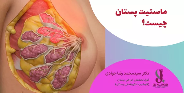 ماستیت پستان چیست؟