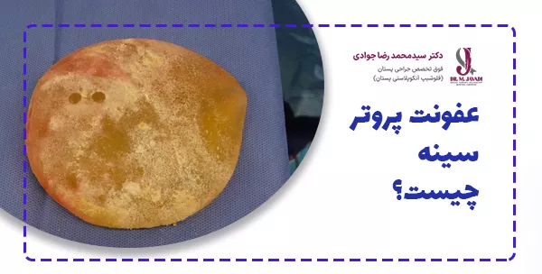 عفونت پروتر سینه چیست؟