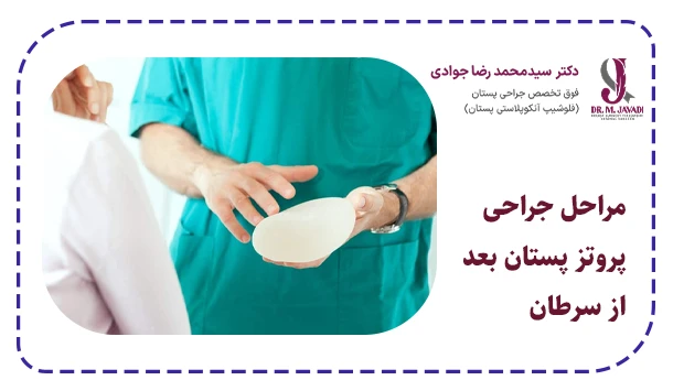 مراحل جراحی پروتز پستان بعد از سرطان