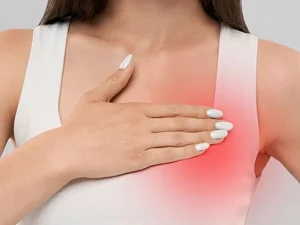سوزش سينه بعد از پروتز