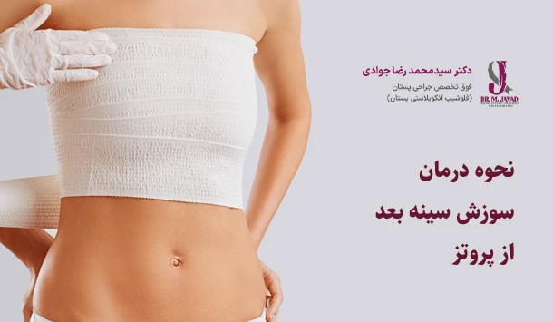 نحوه درمان سوزش سینه بعد از پروتز