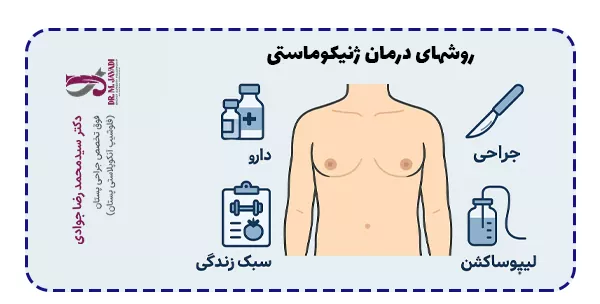 روشهای درمان ژنیکوماستی