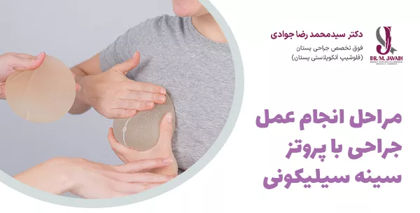 مراحل انجام عمل جراحی با پروتز سینه سیلیکونی