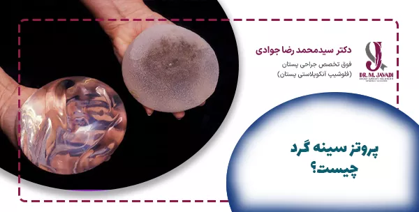 پروتز سینه گرد چیست؟
