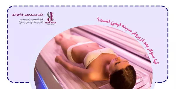 آیا سولار بعد از پروتز سينه ایمن است؟