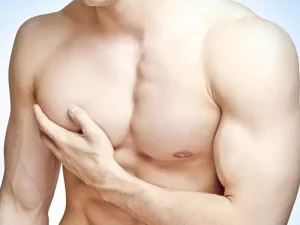 عوارض جراحی ژنیکوماستی
