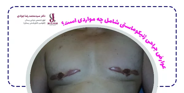 عوارض جراحی ژنیکوماستی شامل چه مواردی است؟