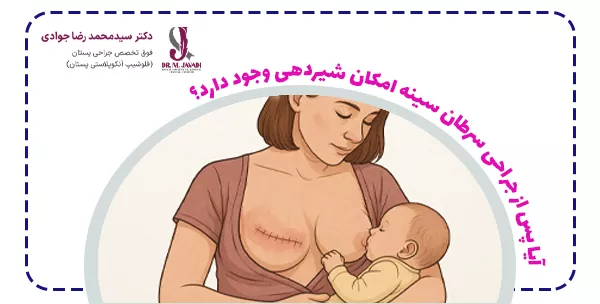 آیا پس از جراحی سرطان سینه امکان شیردهی وجود دارد؟