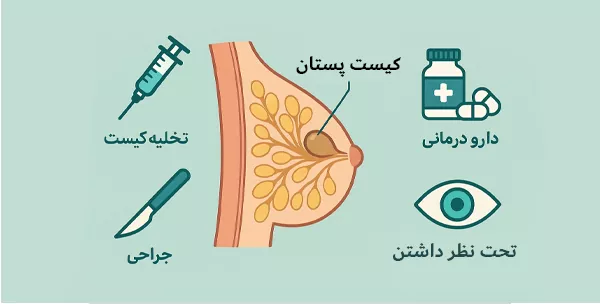روش های درمان کیست پستان روش های درمان کیست پستان