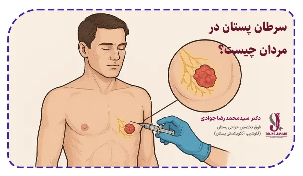 سرطان پستان در مردان چیست