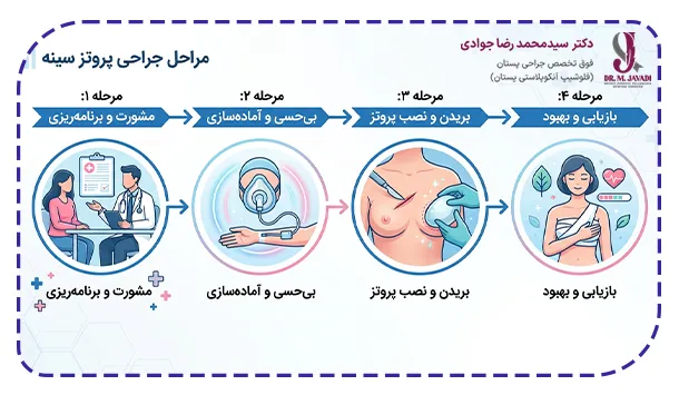 مراحل جراحی پروتز سینه